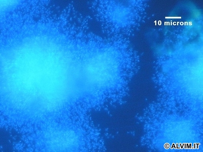 Biofilm under epifluorescence microscopy